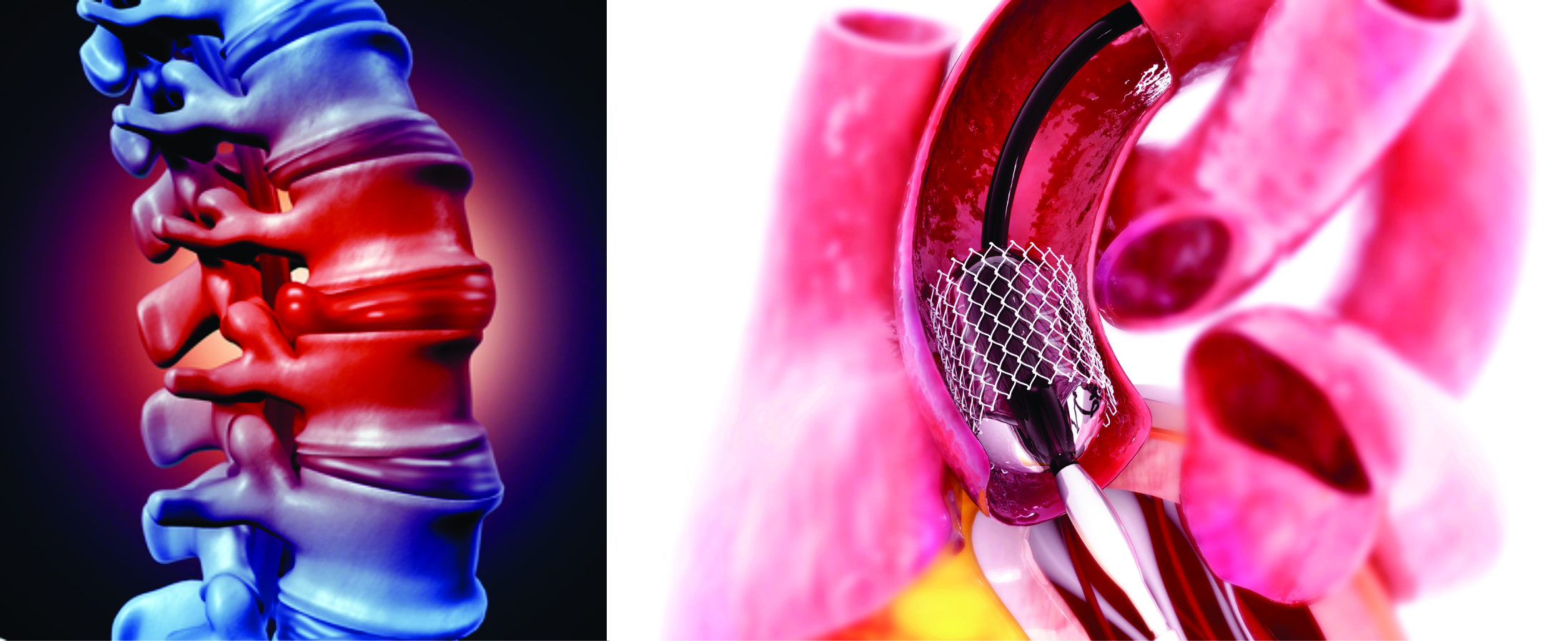 What is the Difference Between Biomechanical          and Biomedical Engineering?